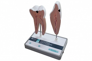 Интерактивная стоматологическая модель кариеса