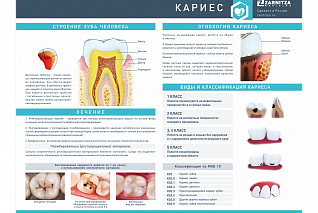 Стенд "Кариес"