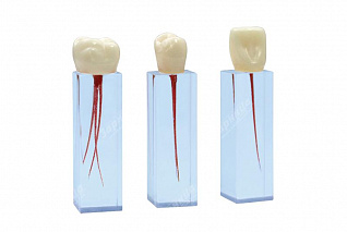 Комплект эндоблоков ЭБ-1.03